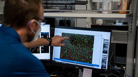 Researcher points to a computer image of cells.